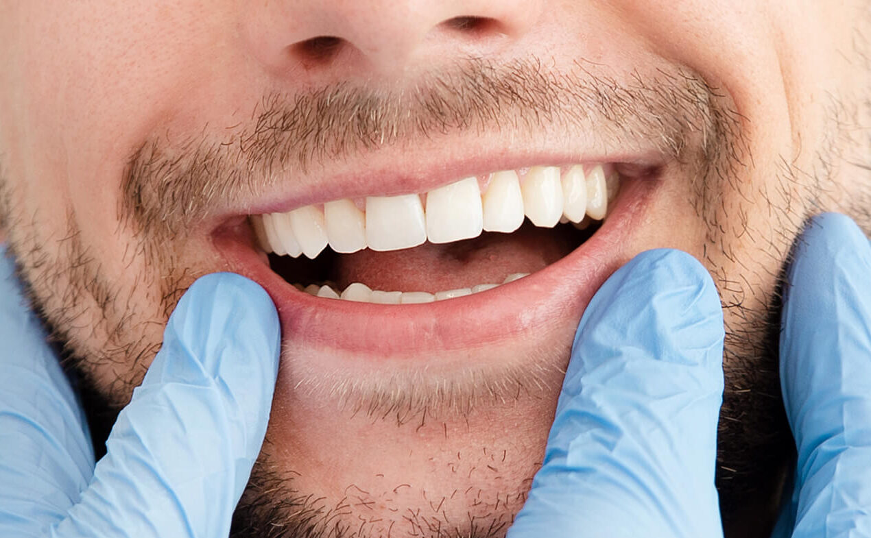closeup of a mans white teeth next to a gloved hand